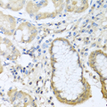 CCL11 / Eotaxin Antibody - Immunohistochemistry of paraffin-embedded human stomach using CCL11 antibody at dilution of 1:100 (40x lens).