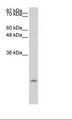 CCL13 / MCP4 Antibody - Transfected 293T Cell Lysate.  This image was taken for the unconjugated form of this product. Other forms have not been tested.