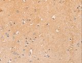 CCL16 / LEC Antibody - Immunohistochemistry of paraffin-embedded Human brain using CCL16 Polyclonal Antibody at dilution of 1:50.