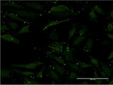 CCL17 / TARC Antibody - Immunofluorescence of monoclonal antibody to CCL17 on HeLa cell . [antibody concentration 10 ug/ml]