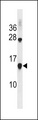 CCL17 / TARC Antibody - CCL17 Antibody western blot of NCI-H460 cell line lysates (35 ug/lane). The CCL17 antibody detected the CCL17 protein (arrow).