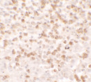 CCL17 / TARC Antibody - Immunohistochemistry of CCL17 in spleen tissue with CCL17 antibody at 5 ug/ml.