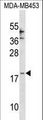 CCL25 / TECK Antibody - CCL25 Antibody western blot of MDA-MB453 cell line lysates (35 ug/lane). The CCL25 antibody detected the CCL25 protein (arrow).