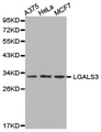 CCL25 / TECK Antibody - Western blot of extracts of various cell lines, using LGALS3 antibody.
