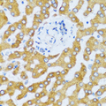 CCL25 / TECK Antibody - Immunohistochemistry of paraffin-embedded human liver tissue.