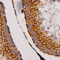 CCL27 Antibody - Immunohistochemical analysis of CCL27 staining in human testis formalin fixed paraffin embedded tissue section. The section was pre-treated using heat mediated antigen retrieval with sodium citrate buffer (pH 6.0). The section was then incubated with the antibody at room temperature and detected using an HRP polymer system. DAB was used as the chromogen. The section was then counterstained with hematoxylin and mounted with DPX.
