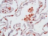 CCL3 / MIP-1-Alpha Antibody - Immunohistochemistry of Human Lung stained with anti-MIP-1 alpha antibody