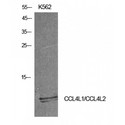 CCL4 / MIP-1 Beta Antibody - Western blot of MIP-1b antibody