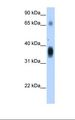 CCN3 / NOV Antibody - Transfected 293T cell lysate. Antibody concentration: 1.25 ug/ml. Gel concentration: 12%.  This image was taken for the unconjugated form of this product. Other forms have not been tested.