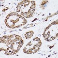 CCN5 Antibody - Immunohistochemistry of paraffin-embedded mouse esophageal cancer tissue.