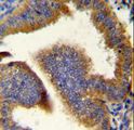 CCNB1 / Cyclin B1 Antibody - CCNB1 Antibody immunohistochemistry of formalin-fixed and paraffin-embedded human uterus tissue followed by peroxidase-conjugated secondary antibody and DAB staining.
