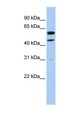 CCNB1 / Cyclin B1 Antibody - CCNB1 / Cyclin B1 antibody Western blot of MCF7 cell lysate. This image was taken for the unconjugated form of this product. Other forms have not been tested.