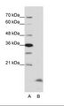CCNB3 / Cyclin B3 Antibody - A: Marker, B: HepG2 Cell Lysate.  This image was taken for the unconjugated form of this product. Other forms have not been tested.
