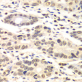 CCNC / Cyclin C Antibody - Immunohistochemistry of paraffin-embedded human colon carcinoma tissue.