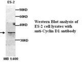 CCND1 / Cyclin D1 Antibody