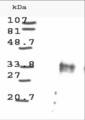 CCND1 / Cyclin D1 Antibody - Western blot analysis is shown using Anti-Cyclin D1 antibody to detect Human Cyclin D1 present in asynchronous HN30 cell lysates. HN30 cells, are from head and neck cancer cells that over express cyclin B1 and D1. Comparison to a molecular weight marker indicates a band of ~34 kD corresponding to the expected molecular weight for the protein (arrowhead). The blot was incubated with a 1:500 dilution of the antibody at room temperature. Detection occurred using a 1:10000 of HRP conjugated Go.