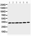 CCND1 / Cyclin D1 Antibody - WB of CCND1 / Cyclin D1 antibody. All lanes: Anti-CCND1 at 0.5ug/ml. Lane 1: Rat Testis Tissue Lysate at 40ug. Lane 2: Rat Ovary Tissue Lysate at 40ug. Lane 3: Rat Brain Tissue Lysate at 40ug. Lane 4: HELA Whole Cell Lysate at 40ug. Lane 5: MM231 Whole Cell Lysate at 40ug. Lane 6: SW620 Whole Cell Lysate at 40ug. Predicted bind size: 33KD. Observed bind size: 33KD.