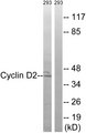 CCND2 / Cyclin D2 Antibody - Western blot analysis of lysates from 293 cells, using Cyclin D2 Antibody. The lane on the right is blocked with the synthesized peptide.