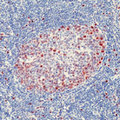 CCND3 / Cyclin D3 Antibody - Formalin-fixed, paraffin-embedded human tonsil stained with peroxidase-conjugate and AEC chromogen. Note nuclear staining of cells.  This image was taken for the unmodified form of this product. Other forms have not been tested.