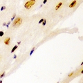 CCNE1 / Cyclin E1 Antibody - Immunohistochemical analysis of Cyclin E1 staining in human heart formalin fixed paraffin embedded tissue section. The section was pre-treated using heat mediated antigen retrieval with sodium citrate buffer (pH 6.0). The section was then incubated with the antibody at room temperature and detected using an HRP conjugated compact polymer system. DAB was used as the chromogen. The section was then counterstained with haematoxylin and mounted with DPX.