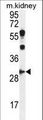 CCNG1 / Cyclin G1 Antibody - CCNG1 Antibody western blot of mouse kidney tissue lysates (35 ug/lane). The CCNG1 antibody detected the CCNG1 protein (arrow).