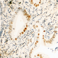 CCNH / Cyclin H Antibody - Immunohistochemical analysis of Cyclin H (pT315) staining in human kidney formalin fixed paraffin embedded tissue section. The section was pre-treated using heat mediated antigen retrieval with sodium citrate buffer (pH 6.0). The section was then incubated with the antibody at room temperature and detected using an HRP conjugated compact polymer system. DAB was used as the chromogen. The section was then counterstained with hematoxylin and mounted with DPX.