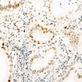 CCNH / Cyclin H Antibody - Immunohistochemical analysis of Cyclin H staining in human kidney formalin fixed paraffin embedded tissue section. The section was pre-treated using heat mediated antigen retrieval with sodium citrate buffer (pH 6.0). The section was then incubated with the antibody at room temperature and detected using an HRP conjugated compact polymer system. DAB was used as the chromogen. The section was then counterstained with hematoxylin and mounted with DPX.