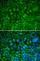 CCNH / Cyclin H Antibody - Immunofluorescence analysis of HeLa cells.