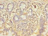 CCNJL Antibody - Immunohistochemistry of paraffin-embedded human small intestine tissue using antibody at dilution of 1:100.