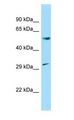 CCNL1 / Cyclin L1 Antibody - CCNL1 / Cyclin L1 antibody Western Blot of Rat Brain.  This image was taken for the unconjugated form of this product. Other forms have not been tested.