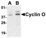 CCNO / UNG2 Antibody - Western blot analysis of Cyclin O in human bladder tissue lysate with Cyclin O antibody at (A) 1 and (B) 2 ug/ml.
