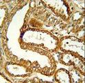 CCR1 Antibody - CCR1 Antibody immunohistochemistry of formalin-fixed and paraffin-embedded human kidney tissue followed by peroxidase-conjugated secondary antibody and DAB staining.
