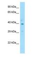 CCR2 Antibody - CCR2 antibody Western Blot of Human Thymus.  This image was taken for the unconjugated form of this product. Other forms have not been tested.