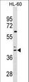 CCR4 Antibody - CCR4 Antibody western blot of HL-60 cell line lysates (35 ug/lane). The CCR4 antibody detected the CCR4 protein (arrow).