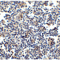 CCR5 Antibody - Immunohistochemistry of CCR5 in human lymph node tissue with CCR5 antibody at 2.5 µg/ml.
