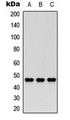 CCRN4L / Nocturnin Antibody - Western blot analysis of Nocturnin expression in HEK293T (A); PC12 (B); HeLa (C) whole cell lysates.