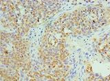CCT6A Antibody - Immunohistochemistry of paraffin-embedded human tonsil tissue using antibody at 1:100 dilution.