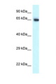 CCT7 Antibody - CCT7 antibody Western blot of Mouse Pancreas lysate. Antibody concentration 1 ug/ml.  This image was taken for the unconjugated form of this product. Other forms have not been tested.