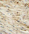 CD105 Antibody - CD105 antibody (Center E395) immunohistochemistry of formalin-fixed and paraffin-embedded mouse heart tissue followed by peroxidase-conjugated secondary antibody and DAB staining. This data demonstrates the use of the CD105 antibody (Center E395) for immunohistochemistry.