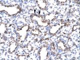 CD105 Antibody - ENG / CD105 antibody ARP33068_T100-NP_000109-ENG (endoglin (Osler-Rendu-Weber syndrome 1)) Antibody was used in IHC to stain formalin-fixed, paraffin-embedded human lung.  This image was taken for the unconjugated form of this product. Other forms have not been tested.