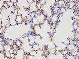CD109 Antibody - Immunohistochemistry of paraffin-embedded Mouse lung using CD109 Polycloanl Antibody at dilution of 1:200.