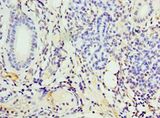 CD119 / IFNGR1 Antibody - Immunohistochemistry of paraffin-embedded human pancreas tissue using antibody at 1:100 dilution.