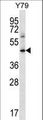 CD119 / IFNGR1 Antibody - IFNGR1 Antibody western blot of Y79 cell line lysates (35 ug/lane). The IFNGR1 antibody detected the IFNGR1 protein (arrow).