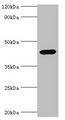 CD121b / IL1R2 Antibody - Western blot All lanes: Interleukin-1 receptor type 2 antibody at 3µg/ml + Mouse kidney tissue Secondary Goat polyclonal to rabbit IgG at 1/10000 dilution Predicted band size: 46, 34 kDa Observed band size: 46 kDa