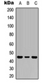 CD121b / IL1R2 Antibody - Western blot analysis of IL-1R2 expression in HEK293T (A); Raw264.7 (B); PC12 (C) whole cell lysates.