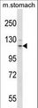 CD135 / FLT3 Antibody - Mouse Flt3 Antibody western blot of mouse stomach tissue lysates (35 ug/lane). The Flt3 antibody detected the Flt3 protein (arrow).