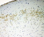 CD144 / CDH5 / VE Cadherin Antibody - CD144 / CDH5 / VE Cadherin antibody. IHC(P): Rat Brain Tissue.