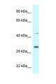 CD157 Antibody - BST1 antibody Western blot of COL0205 Cell lysate. Antibody concentration 1 ug/ml.  This image was taken for the unconjugated form of this product. Other forms have not been tested.