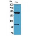 CD163L1 / SCART1 Antibody - Western blot of CD163b antibody
