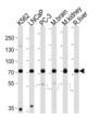 CD164 Antibody - Western blot of lysates from K562, LNCaP, PC-3 cell line, mouse brain, mouse kidney, rat liver tissue lysate (from left to right), using CD164 antibody diluted at 1:1000 at each lane. A goat anti-rabbit IgG H&L (HRP) at 1:10000 dilution was used as the secondary antibody. Lysates at 20 ug per lane.